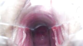 badtekila и вагинальный расширитель