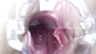 badtekila и вагинальный расширитель